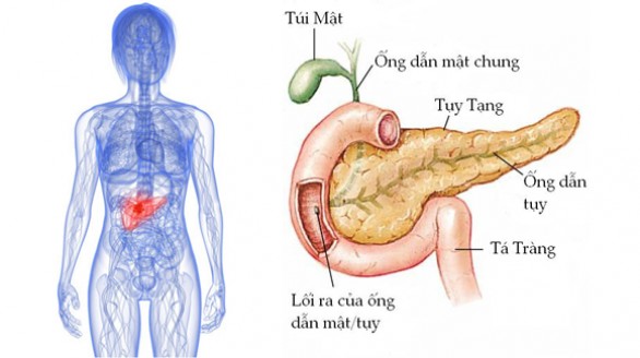 Những dấu hiệu của căn bệnh đáng sợ: Ung thư tuyến tụy